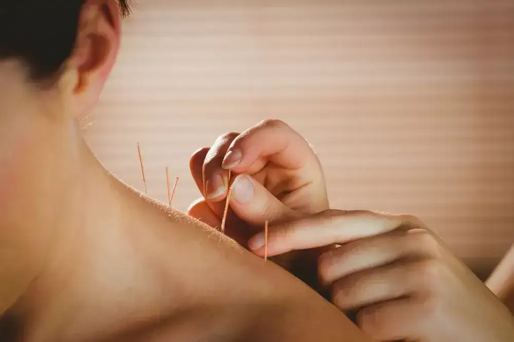 In-Oakville-our-Acupuncture-service