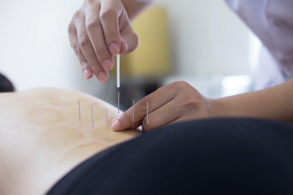 Lower-Back-Pain-Acupuncture