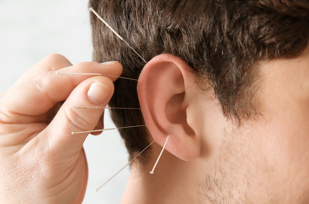 Which-Diseases-Can-be-Helped-by-Acupuncture