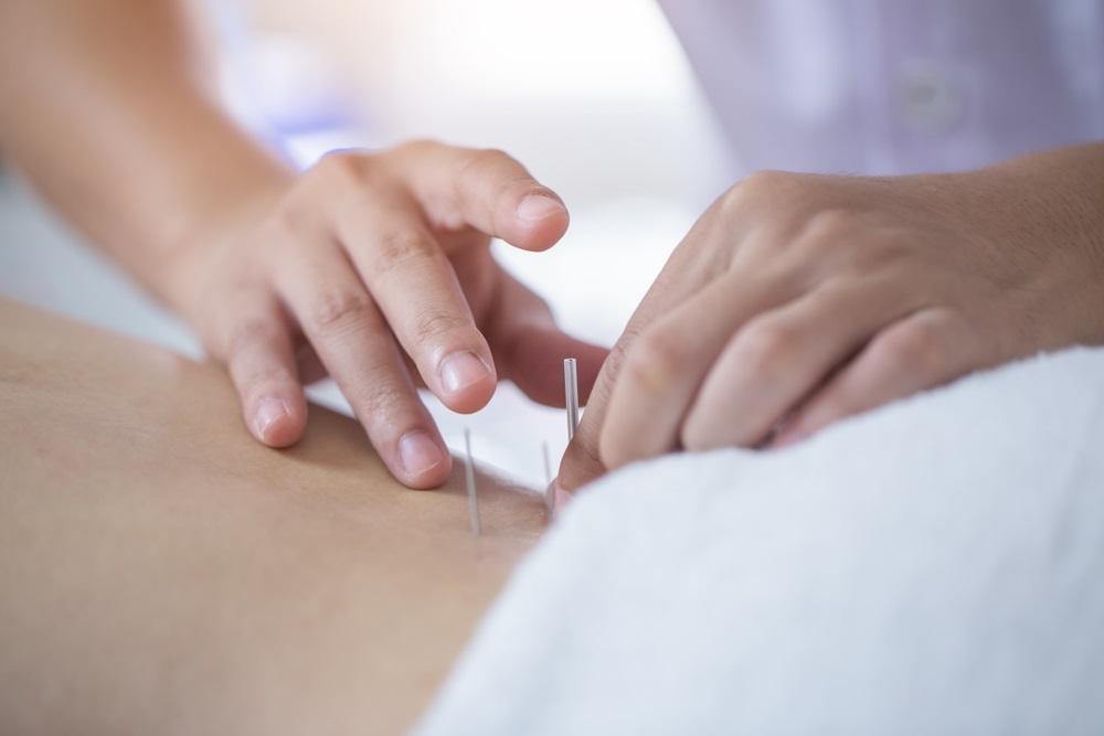 acupuncture-treatments-are-safe-effective-painless