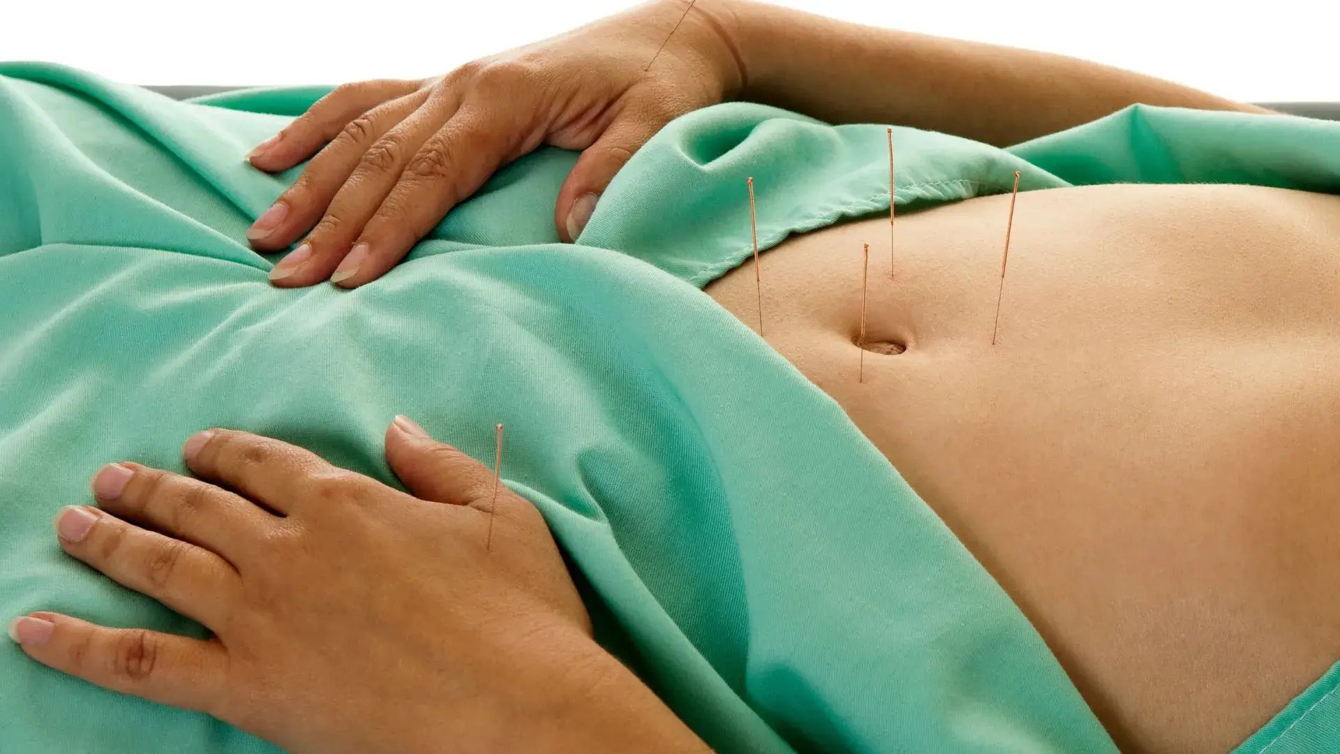 Acupuncture Pregnancy Induction Methods