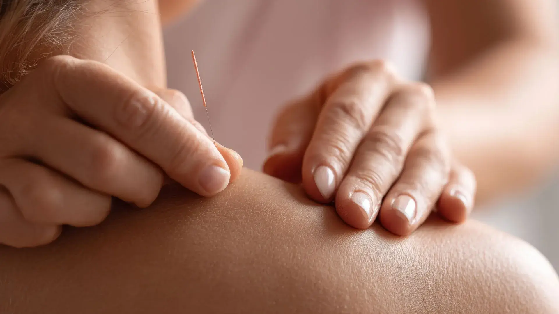 Acupuncture during Pregnancy and Its benefits